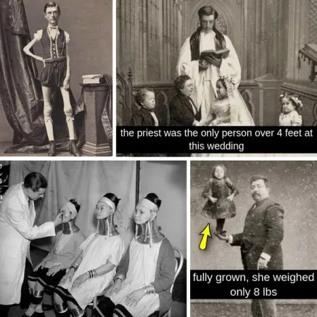 The lives of these freak show performers were stranger than their oddities th