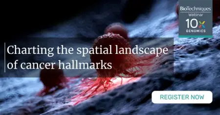 Watch on-demand Charting the spatial landscape of cancer hallmarks
Ever wo