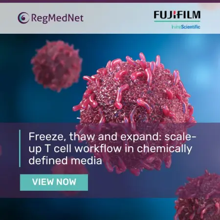 Using chemically defined media has benefits at every stage of your cell therapy workflow. E
