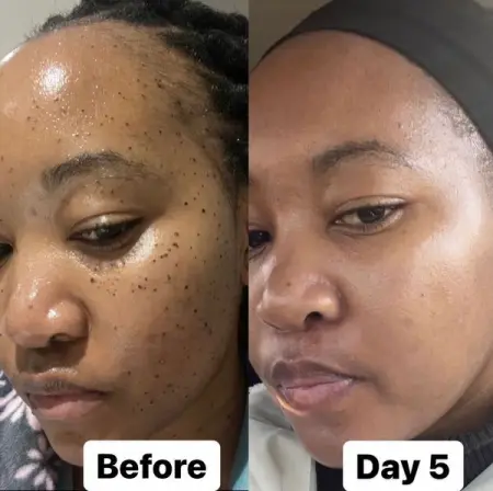 SKIN TAG REMOVAL COASTAL TOUR 
 Coming To A City Near You 

 Tour Dates 
Cape To