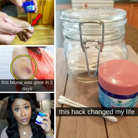 Seriously, this stuff might be magic.
REALLIFEDIY.COM
30 Vaporub Hacks Tha