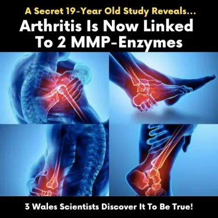 URGENT REPORT!

Could This Be The Real Cause Of Arthritis?

 httpswww.relief.nglp

After