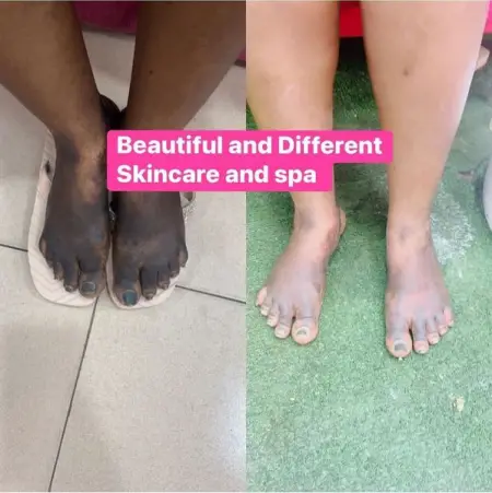 Before and After our knuckle paraffin wash
Price -10k
Call or WhatsApp us on08060705323