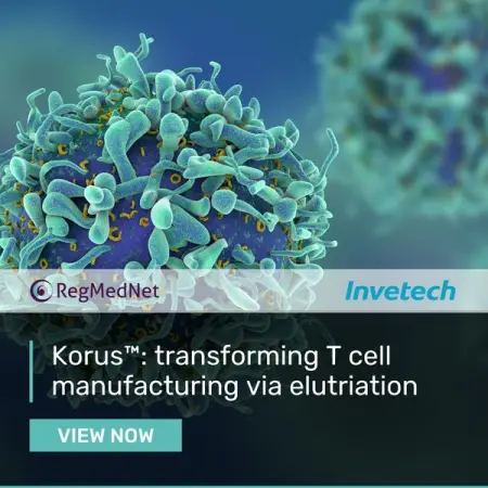 Learn more about how elutriating lymphocytes from apheresis can provide a more consistent