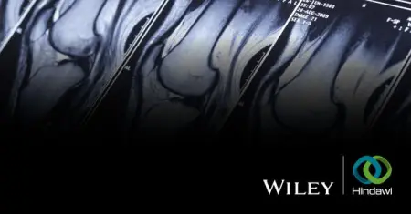 Reach a global community with your research by publishing your next paper open access