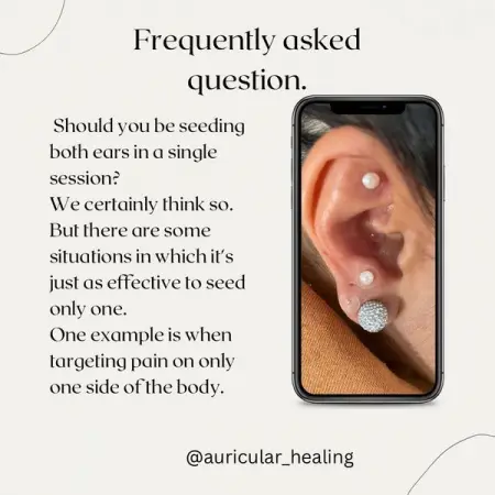 Should I seed on both sides?
This is a common question.
Personally I prefe