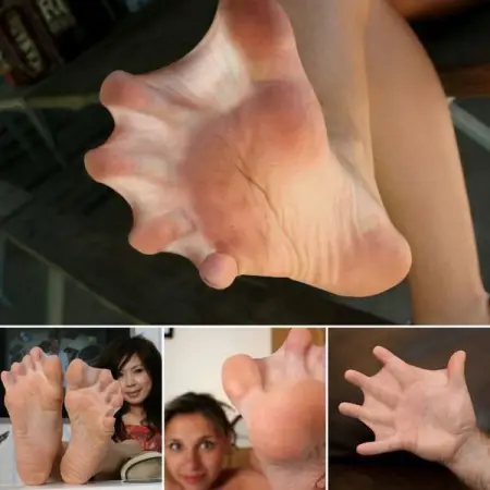 Wait Till Seeing Her Swimming Skills 33 Unique People Whose Genetics Made Them 