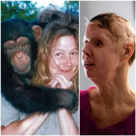 Hes eating her! Shoot him! screamed the chimps owner - the pet inflicted terrible har