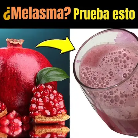 Estoy en la industria de la salud con dcadas de experiencia con lo melasma y sus e