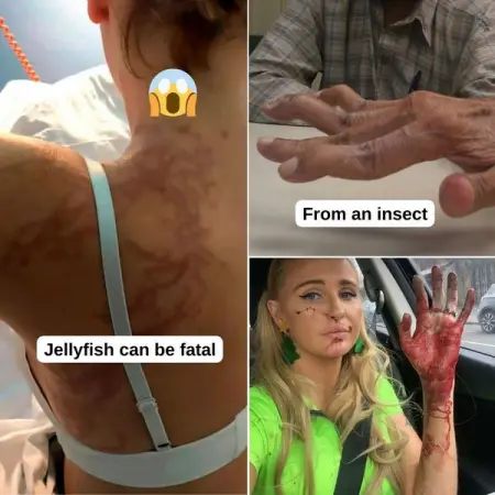 To defend themselves and to attack when provoked, all animals have distinct fe