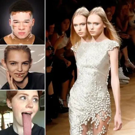 What are rare genetics? 30 people who have really unique genetics
NEWS.SCIENCE101.C