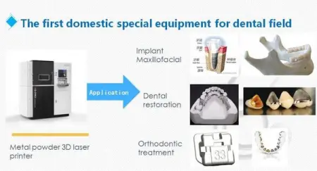 Riton dental metal 3D printer , looking for agent .
Maintained the Championship in d