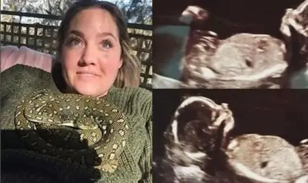 6 semanas despus del parto, la mujer se siente rara. El doctor seala su ultrasonido y el 