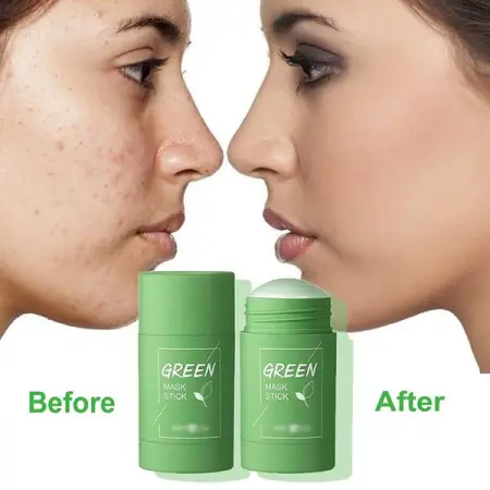 GREEN MASK STICK SKIN REPAIR AND SPOT REMOVER.
For Inadequate daily cleaning often causes va