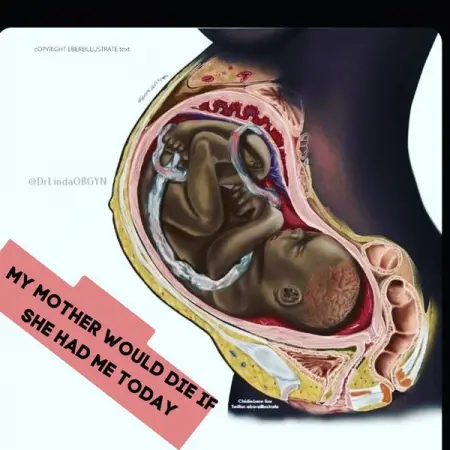 When my mother had me, there were no managed care organizations that booted women 