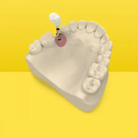 First Website for Digital Dentistry Freelancer
Start Your Digital Journey today http