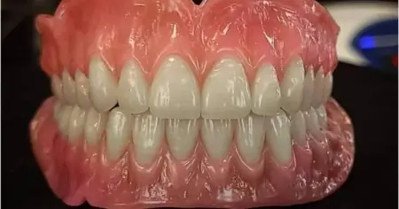 Laboratoire Dentaire Benmoussa 
                100 .
 0554 34 28 46
Wh