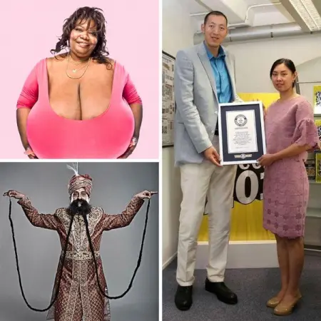 21 Human Body World Records That Are Hard to Handle
MEDICAL-NEWS.ORG
World Records t