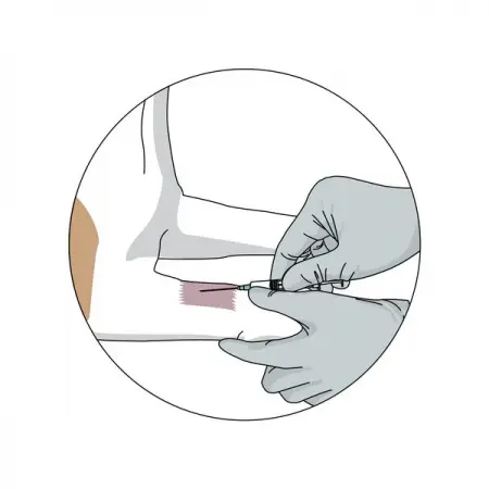 MINDTHEGRAPH.COMVETERINARY
Dog cephalic catheter placement zoom
Learn More
 