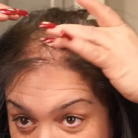 From head massages to garlic paste, these 20 remedies could halt peoples hair lo