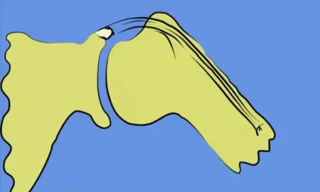 Heres a great 2 minute snippet from Dr Rod Whiteley on the mechanism of labr