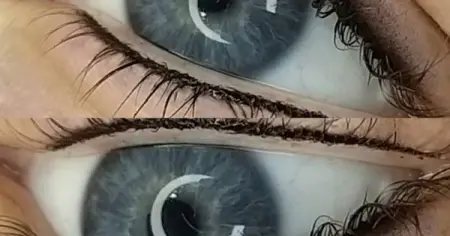 Faded eyeliner is one of our popular procedures. We use the latest technology namely