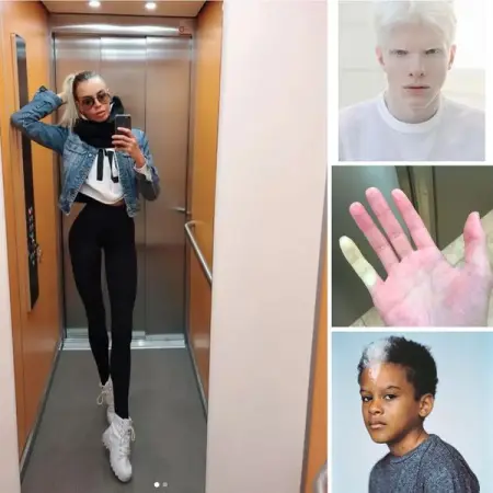 40 Photos of Beautiful Genetics From Around The World
YOURMONEYMAGIC.COM
40 Photos of Beau